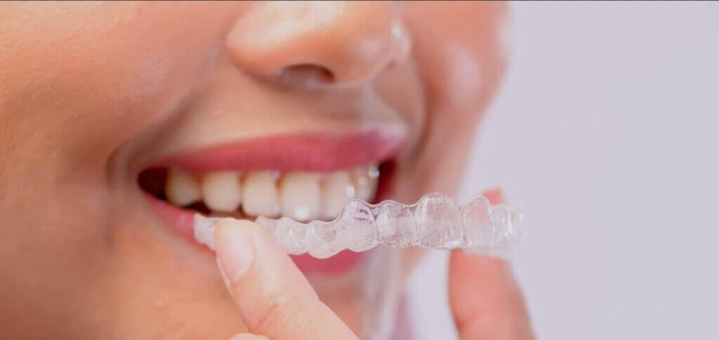 Best Invisalign® in Brooklyn, NY Cost, Insurance, Self-Pay Options, Types | Invisalign vs. Braces | ParkSide Dental