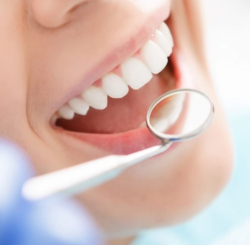 Prolonging Your Whitening Results with Best Brooklyn Dentist