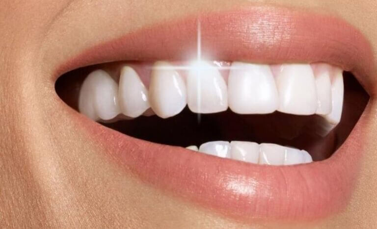 Best Brooklyn Teeth Whitening Dentist, Cost, Insurance, removing stains