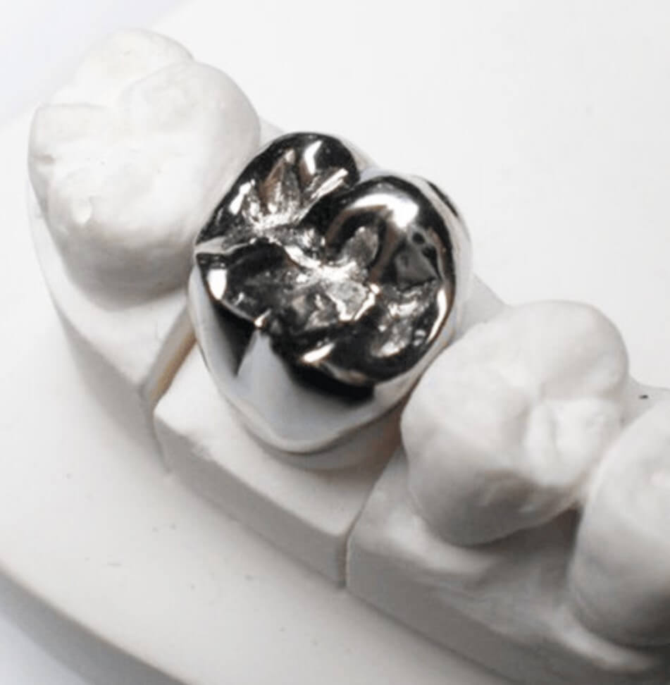 Metal Crown main image 1