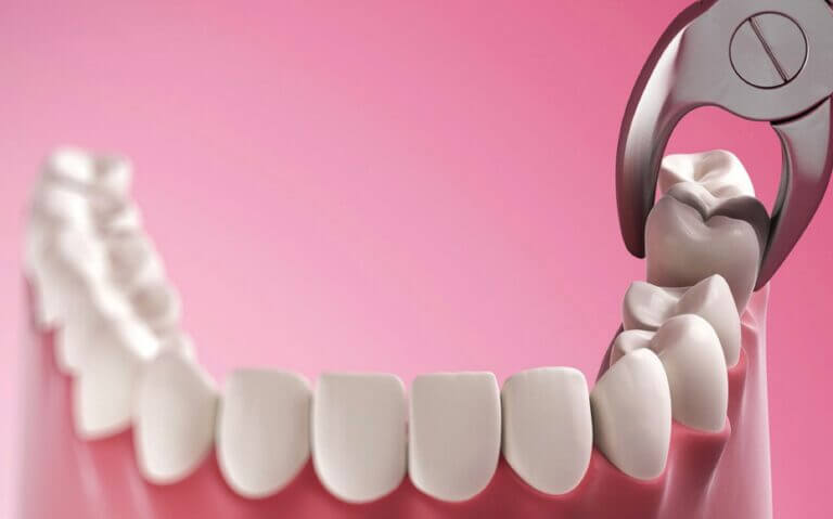 Top Brooklyn NY Oral Surgeon, cost, insurance, benefits dentist oral surgery