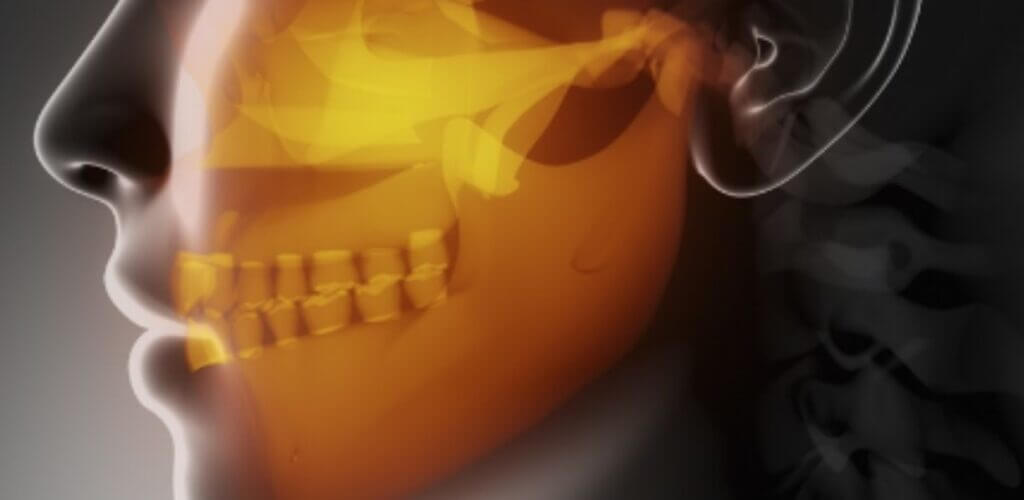 Brooklyn NY What is Temporomandibular Disorder (TMD) or Temporomandibular Joint Disorder (TMJ)?