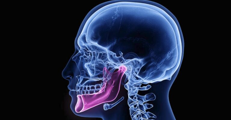 Top Brooklyn Mini TMJ Treatment & Pain Relief Dentist Near Me - Cost, Insurance, Self-pay options
