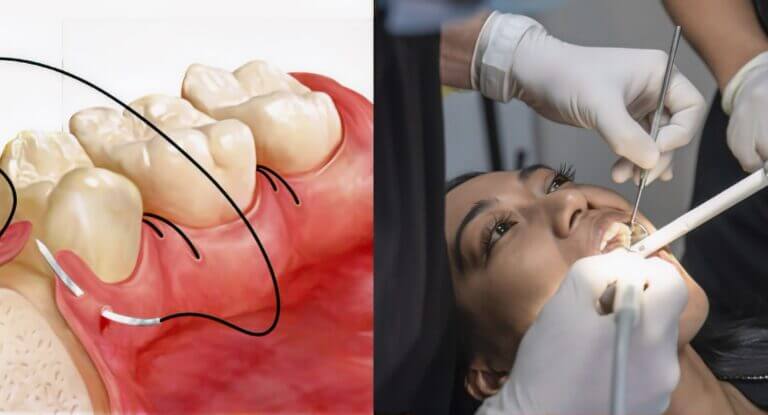 Navigating Oral Surgery in Brooklyn: Expert Tips for Choosing the Right Specialist