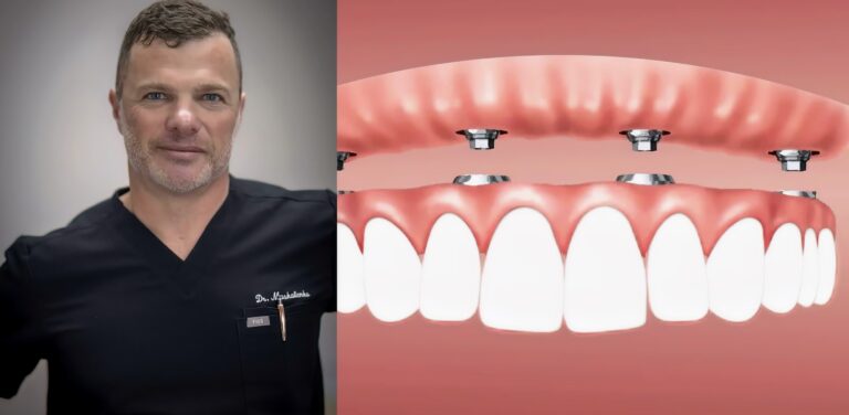Affordable Full Mouth Dental Implants Near Me in Brooklyn, NY Cost, Insurance, High Quality All-on-4