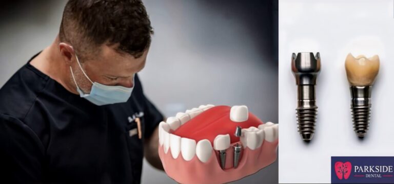 Dentures vs. Dental Implants Insurance, Cost, Benefits, Pros and Cons NYC