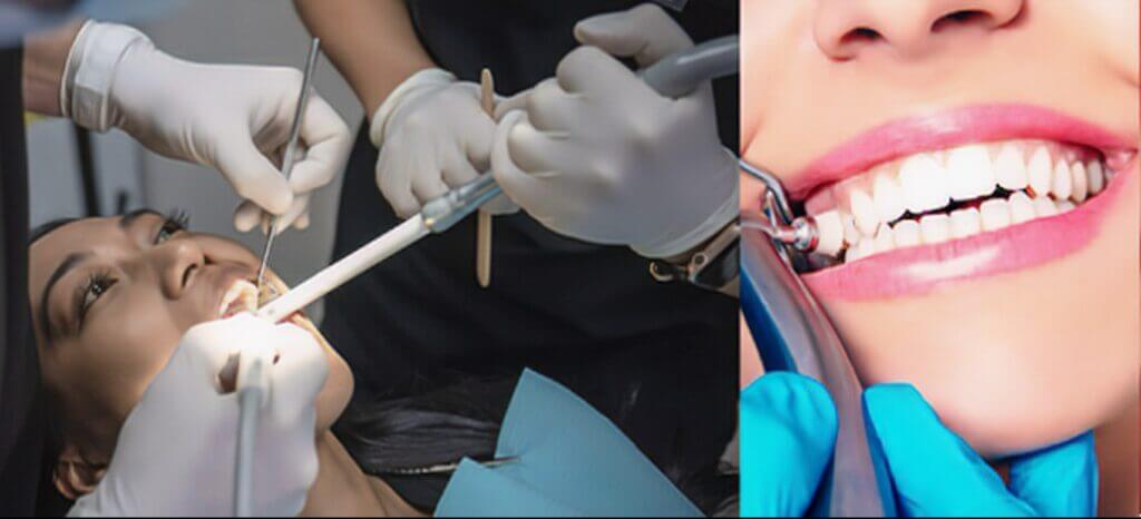 Treatment Options for Decayed Teeth in NYC