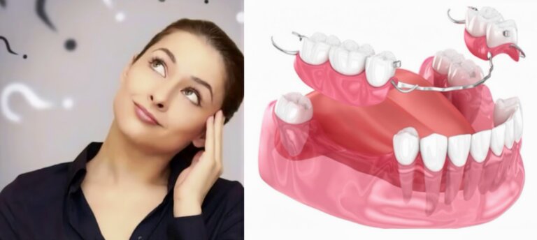 Rediscovering Your Smile: Understanding Partial Dentures