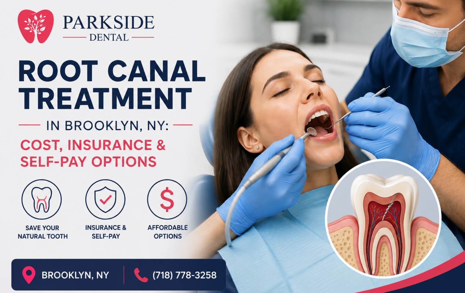 Root canal treatment in Brooklyn, NY at ParkSide Dental with insurance and self-pay options